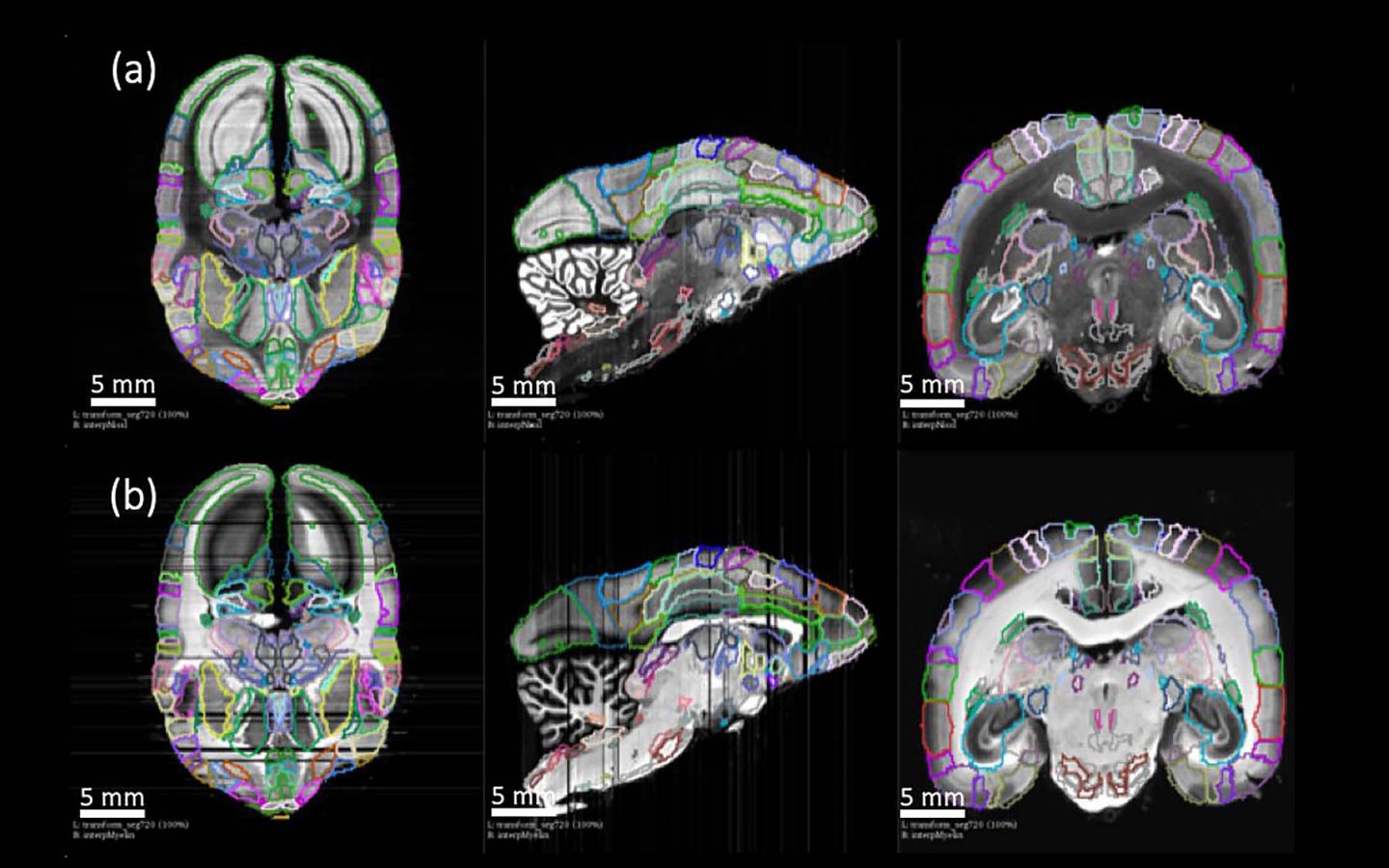 Caption - Primate Brain , HD Wallpaper & Backgrounds