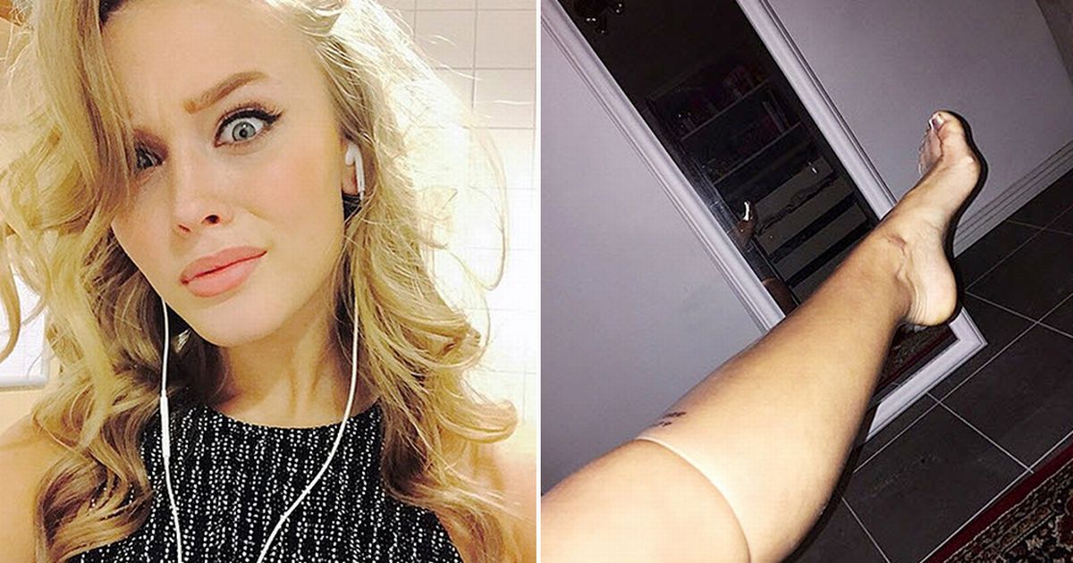 Swedish Singer Mocks Men 'too Big' For Condoms By Putting - Zara Larsson Condom Over Leg , HD Wallpaper & Backgrounds