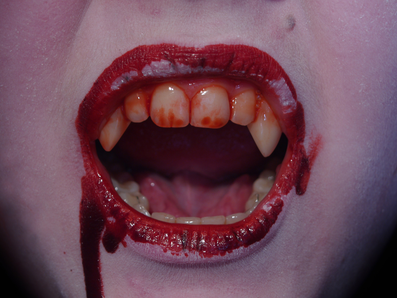 Vampire Teeth Bloody , HD Wallpaper & Backgrounds