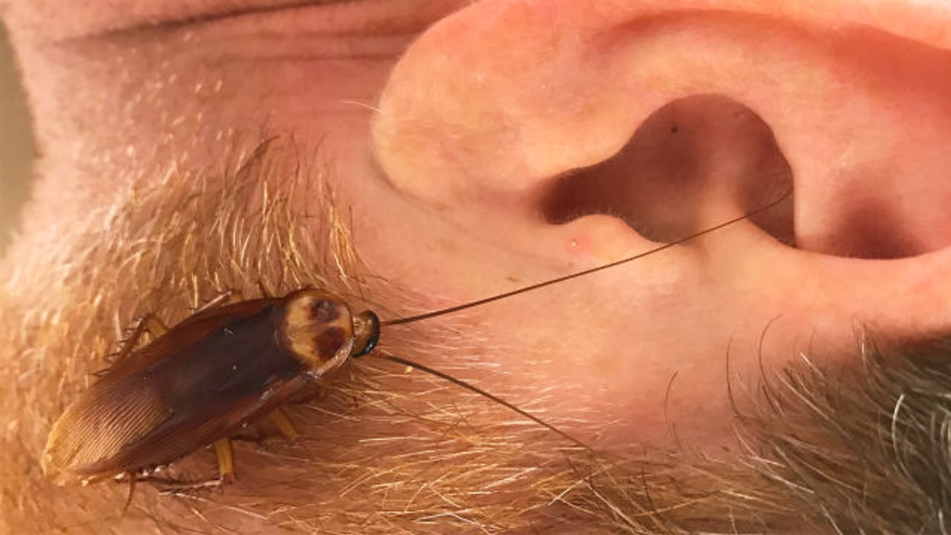 Cockroach In Ear , HD Wallpaper & Backgrounds