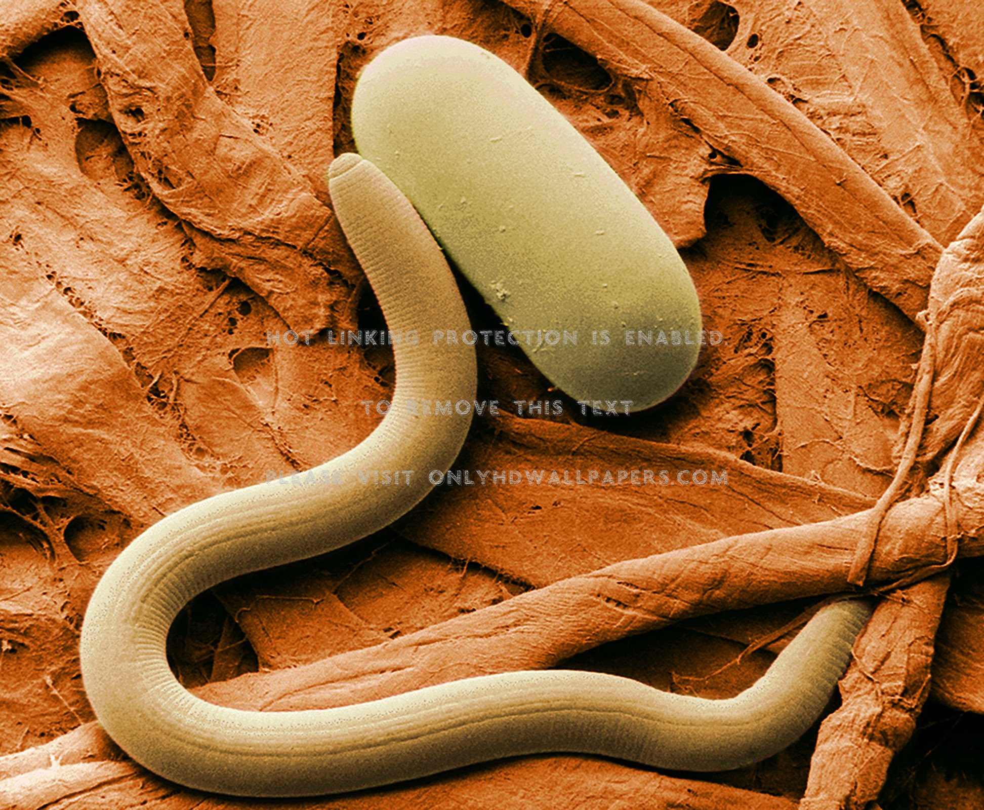 Economic Importance Of Roundworm , HD Wallpaper & Backgrounds