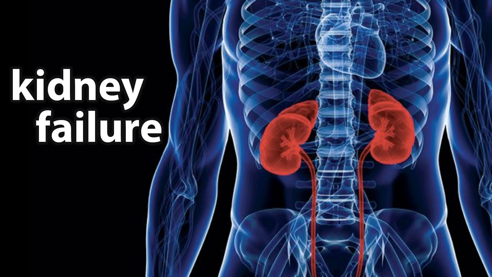 Kidneys Filter Waste Products From The Bloodstream - Kidney Failure , HD Wallpaper & Backgrounds