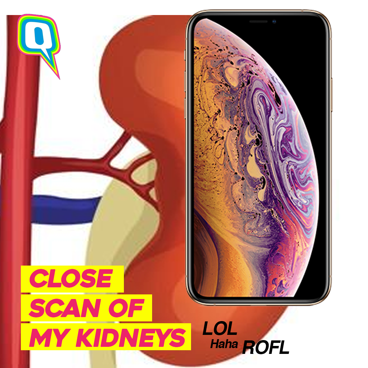 Original Like Every Other Kidney Joke Out There - Oneplus 6t Vs Iphone Xs Vs Pixel 3 , HD Wallpaper & Backgrounds