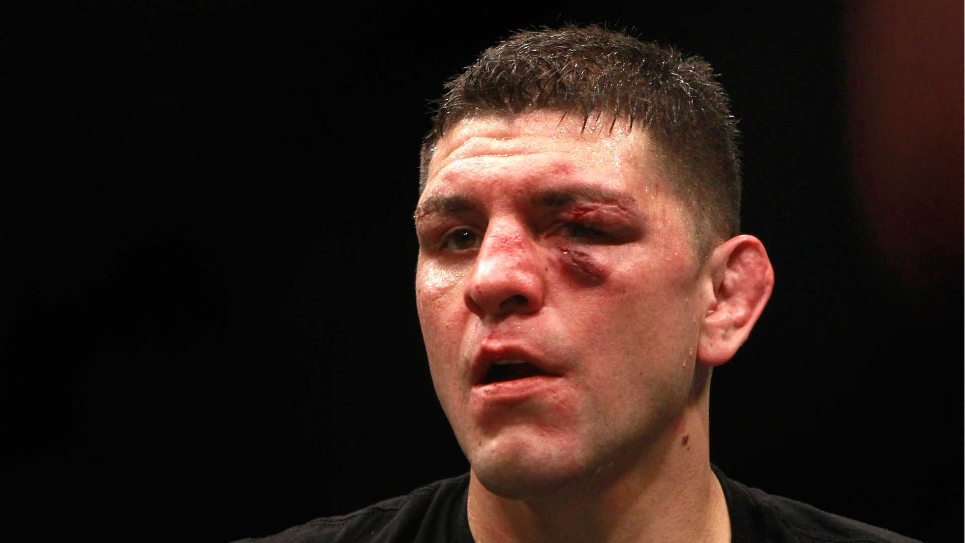 2018 Nick Diaz , HD Wallpaper & Backgrounds