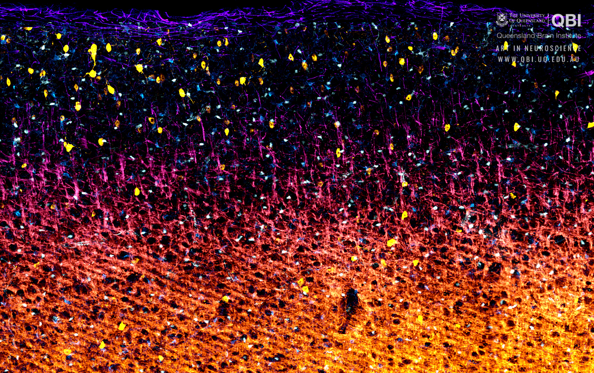 This Cortex Is On Fire By Kok-siong Chen, Richards - Neurology , HD Wallpaper & Backgrounds