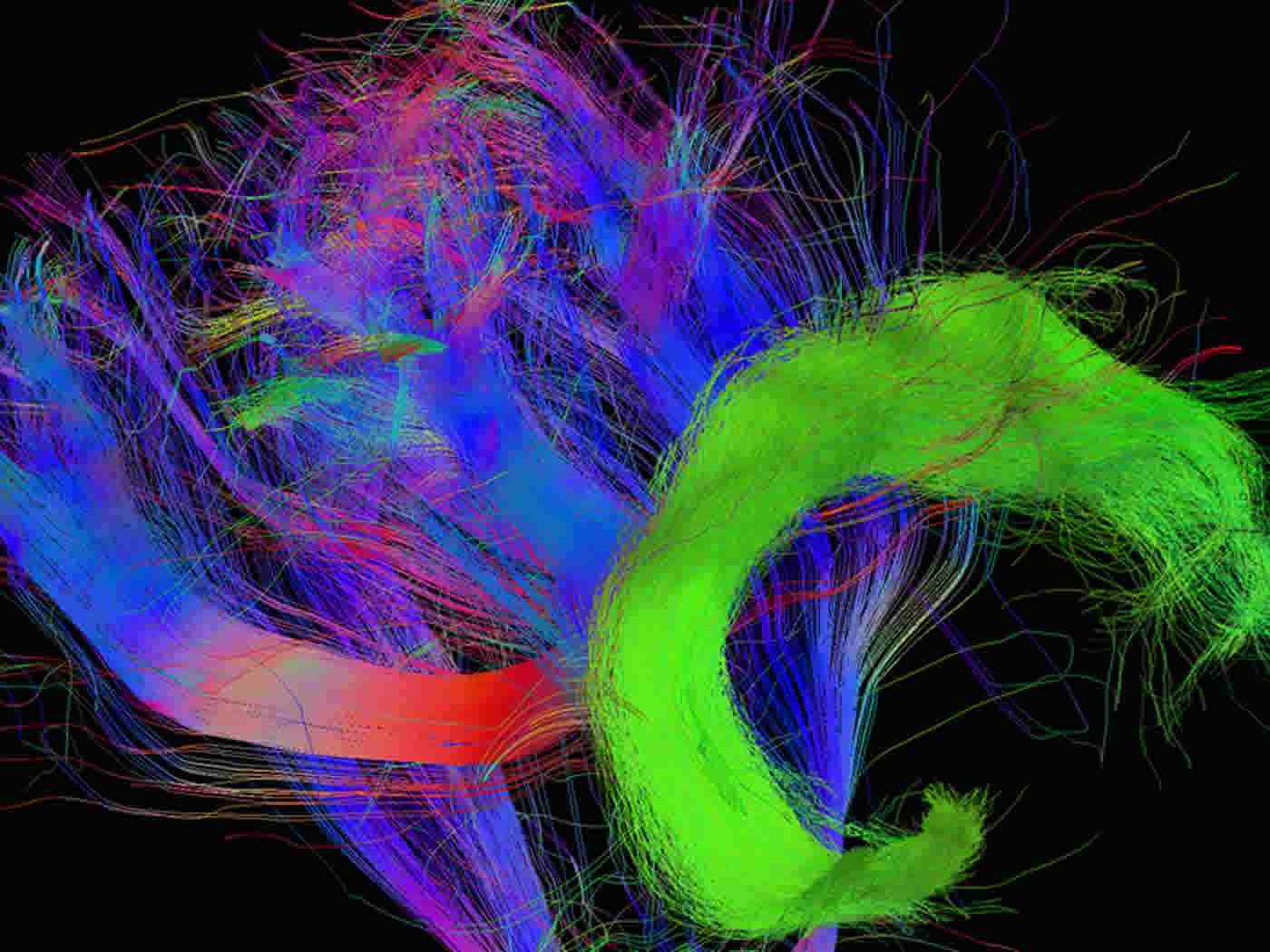 Thanks To A Critical Fibre Connection In The Brain - Arcuate Fasciculus , HD Wallpaper & Backgrounds