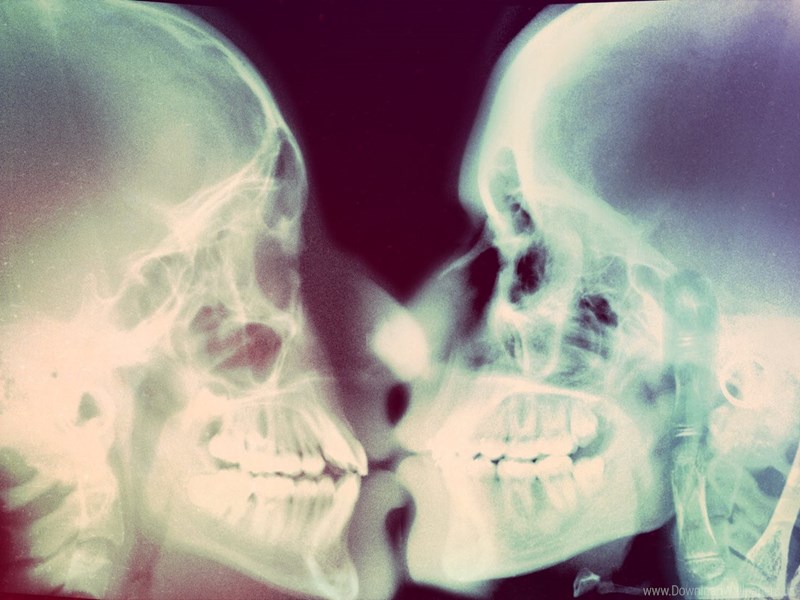 X Ray Skeleton Kiss , HD Wallpaper & Backgrounds