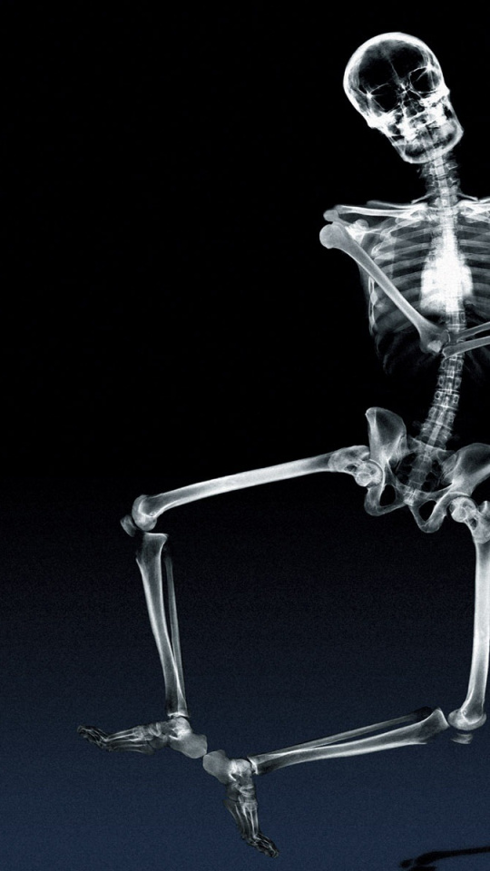 Radiology, Human Skeleton, Radiography, Skull, X Ray - Dancing Skeleton X Ray , HD Wallpaper & Backgrounds