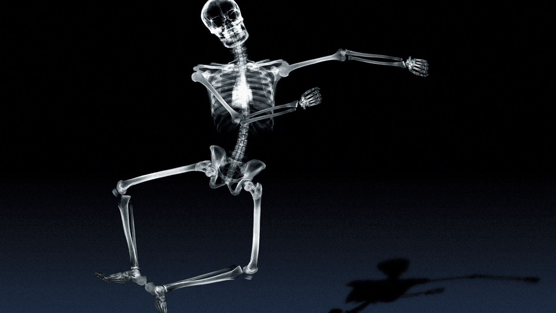 Radiology, Human Skeleton, Radiography, Skull, X Ray - Dancing Skeleton X Ray , HD Wallpaper & Backgrounds