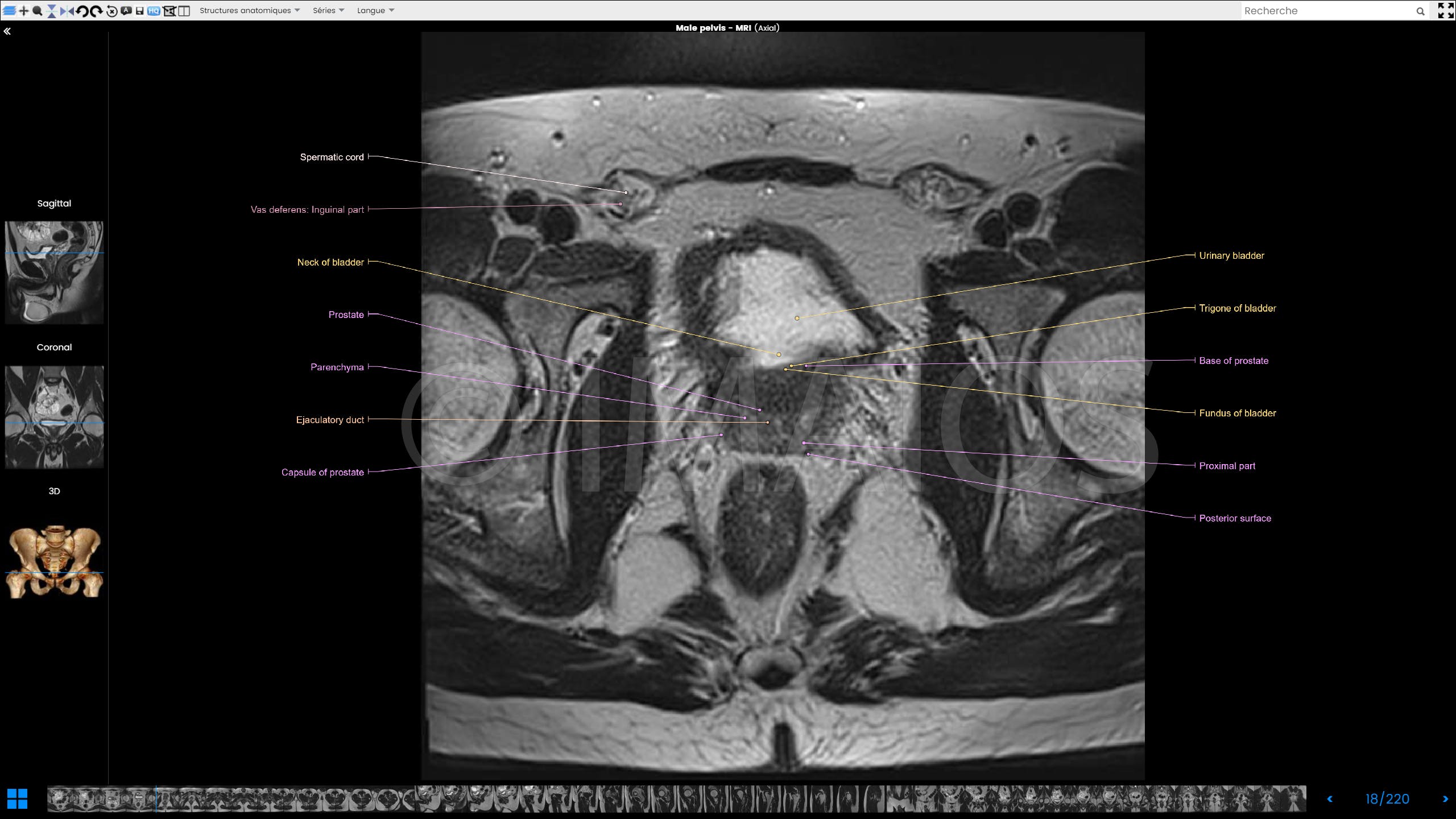 Anatomy Of The Male Pelvis On - Mri Of Male Pelvis , HD Wallpaper & Backgrounds