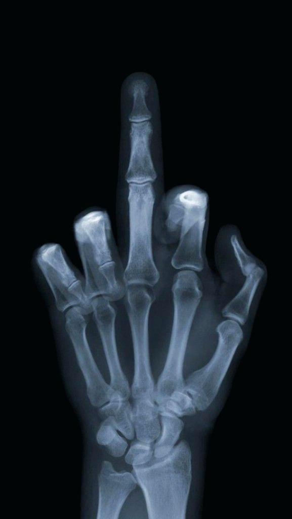 Middle Finger X Ray , HD Wallpaper & Backgrounds