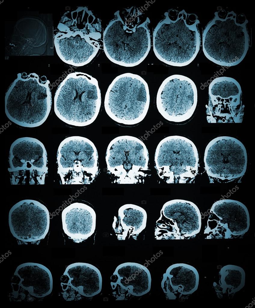 Healthcare And Medical Wallpaper With The Ct Scan Image - Papel De Parede Medico , HD Wallpaper & Backgrounds
