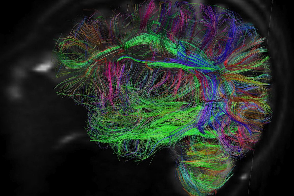 Human Brain Wallpaper - Psychopathy Brain , HD Wallpaper & Backgrounds