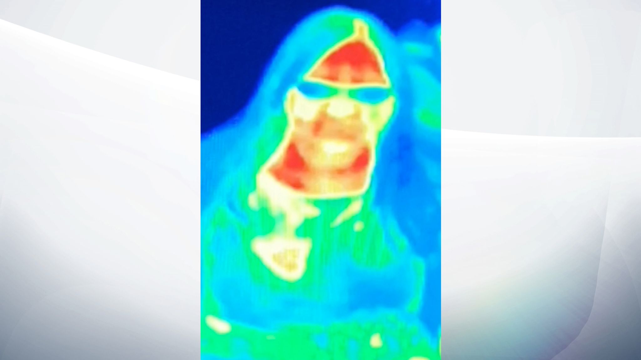 The Image Showed A Heat Patch On Her Left Breast - Breast Cancer Thermal Imaging , HD Wallpaper & Backgrounds