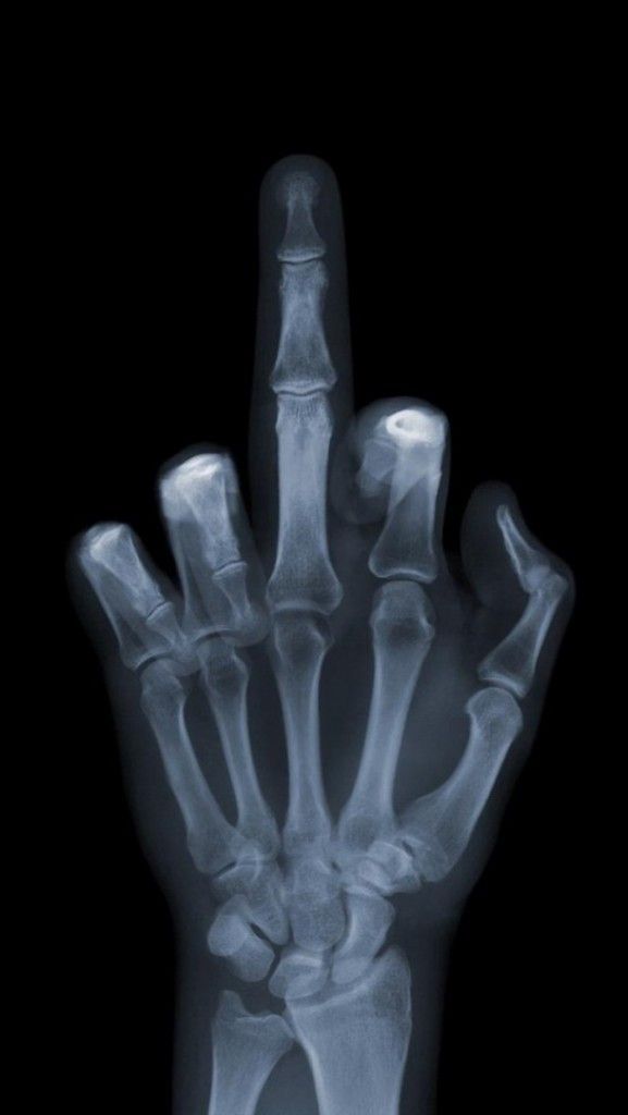 X Mobile Phone Wallpapers Hd Cellphone Wallpaper Img - Middle Finger X Ray , HD Wallpaper & Backgrounds